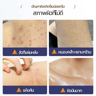 LYDIMOON เจลอาบน้ำแอนตี้แบคทีเรีย สบู่อาบน้ํา เจลอาบน้ำแก้คัน 500ml กำมะถันครีมอาบน้ำ ลดรอยดำ ผดผื่น สิวหลัง หน้าอก หลัง