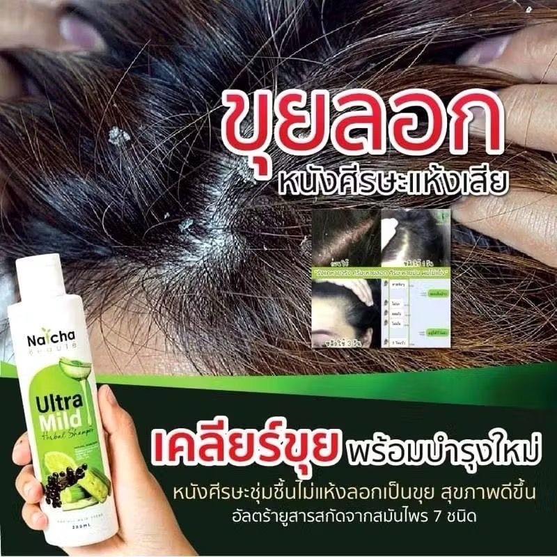 แชมพูณัชชา อัลตร้ามายด์ ณัชชา ออร์แกนิก สะเก็ดเงิน ผิวหนังอักเสบ รังแค คัน 200ml.