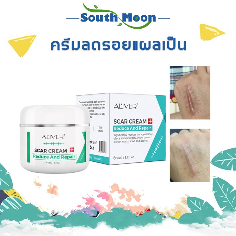 【จัดส่งจากกรุงเทพฯ】ALIVER รอยแผลเป็น ครีมลบรอยแผลเป็น 50ML 🍀 สูตรพืช อ่อนโยนไม่ระคายเคือง ลดรอยแผลเป็น รอยแผลเป็นจากสิว