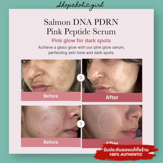 ✅แท้/พร้อมส่ง✅Medicube PDRN Pink Peptide Ampoule 30ml เซรั่มผิวโกลว ลดรอยดำ ✨ใช้คู่กับ Medicube Pro ดีมาก
