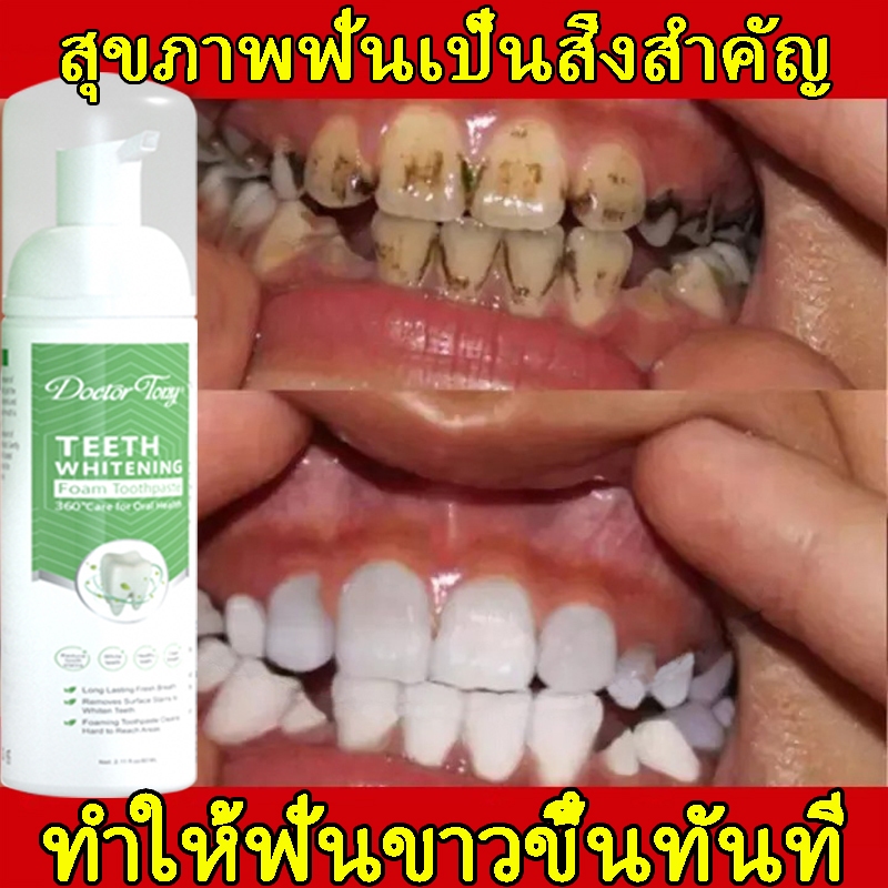 ยาสีฟันไวท์เทนนิ่ง ฟอกสีฟัน มูสฟอกฟันขาว ขจัดคราบหินปูนสีเหลือง ขจัดคราบหินปูน ยาสีฟัน ดับกลิ่นปาก สดชื่น 60ml