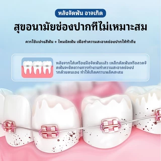 SHIMANG ไหมขัดฟันแบบแท่งลวดคู่สำหรับจัดฟัน 100 ชิ้น/แพ็ค พกพาสะดวก สะอาดฟันและเครื่องมือจัดฟัน