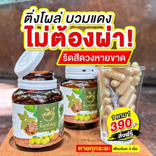 ริชชี่พิมพ์พญา Richy สมุนไพรพิมพ์พญา ริดสีดวง ติ่งยุบ อักเสบ…