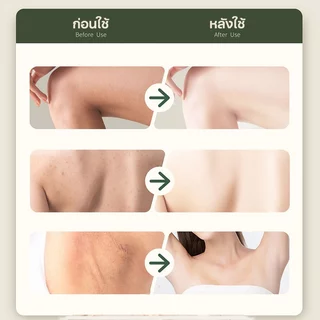 สครับกรดผลไม้ สครับขัดผิวกาย ไวท์เทนนิ่ง ผลัดเซลล์ผิวทั้งตัว ขัดขี้ไคล ให้ความชุ่มชื้น ปรับปรุงผิวหยาบกร้าน