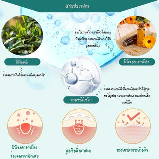 แผ่นแปะดูดสิว แผ่นแปะสิว ปกปิดรอยสิว แผ่นสติกเกอร์แปะสิว 28 ชิ้น รักษาสิว แผ่นดูดสิว รูปดาว หลากสี กันน้ำ