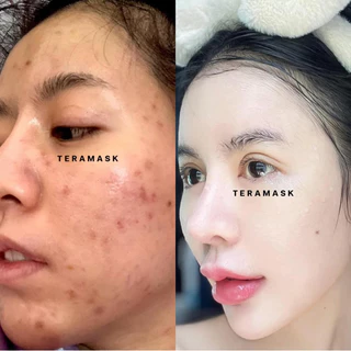 วิตามินหน้าใส เทร่ามาส์ก มาส์กบำรุง กลางคืน Teramask