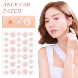 แผ่นสติกเกอร์แปะสิว แผ่นแปะดูดสิว แผ่นดูดสิว น่ารักแผ่นแปะสิว น่ารักแผ่นสิว สําหรับติดตกแต่งสิว