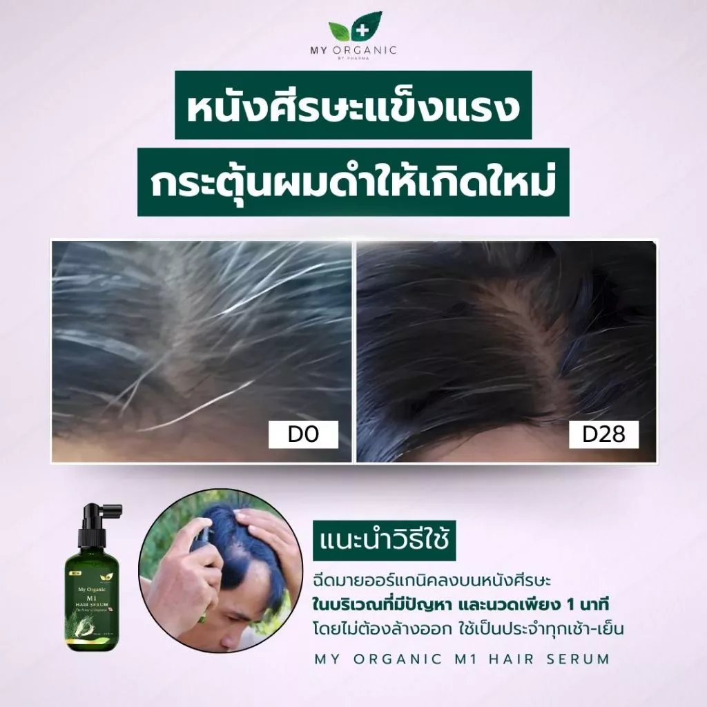 My Organic เซรั่มผมดำ ผมหงอก 20ml ออร์แกนิค ไม่ย้อมผม thumbnail 8