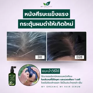 [โปรใหม่ก.ค.][ส่งฟรี] My Organic เซรั่มผมดำ ผมหงอก 20ML เบื่อย้อมผม สูตรออแกนิค แฮโทนิค บำรุงเส้นผม ผมร่วง ผมบาง ผมหงอก