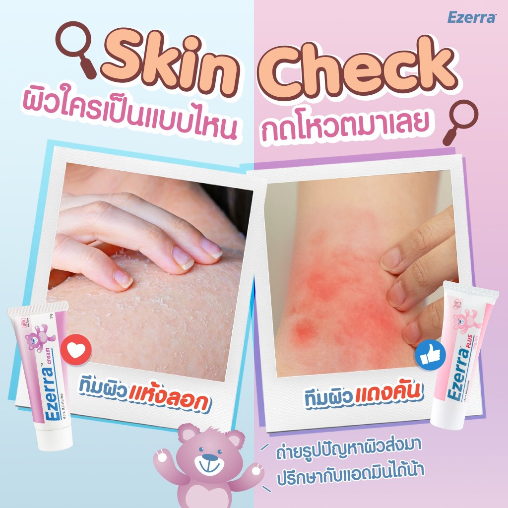 Ezerra Cream / Ezerra Plus Cream / Ezerra Lotion / Ezerra extra gentle cleanser - รูปที่ 4