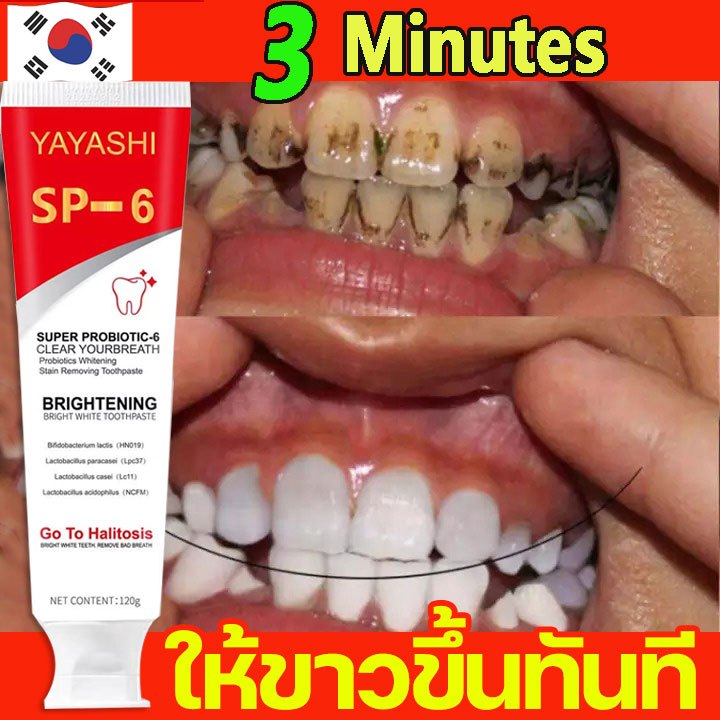 (ของแท้+พร้อมส่ง) ยาสีฟันไวท์เทนนิ่ง ยาสีฟันฟันขาว ลบคราบฟัน คราบหินปูน ฟอกฟันขาวยาสีฟัน ฟันขาว Toothpaste