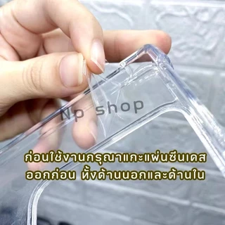 เคสใส คิงคอง สำหรับ Vivo Y05 Y31D V60 lite Y39 Y04 V50 lite X200 Pro Y300 Y19S Y200 V60lite กันกระแทก For วีโว่ X200Pro