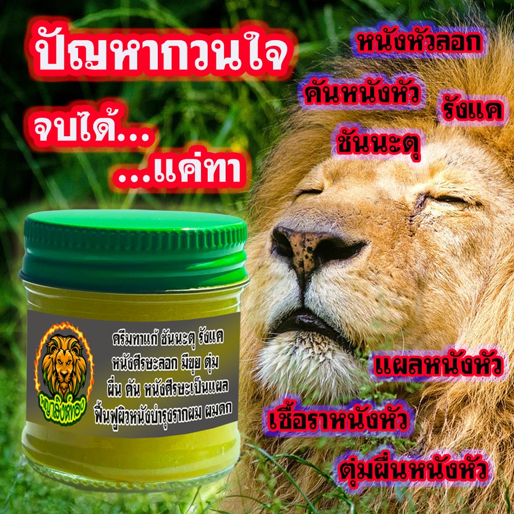 ปราบชันนะตุบนหนังหัว คันหัวจากรังเเค ผมร่วงเป็นหย่อมๆ หัวลอกแห้ง – โปรปัง