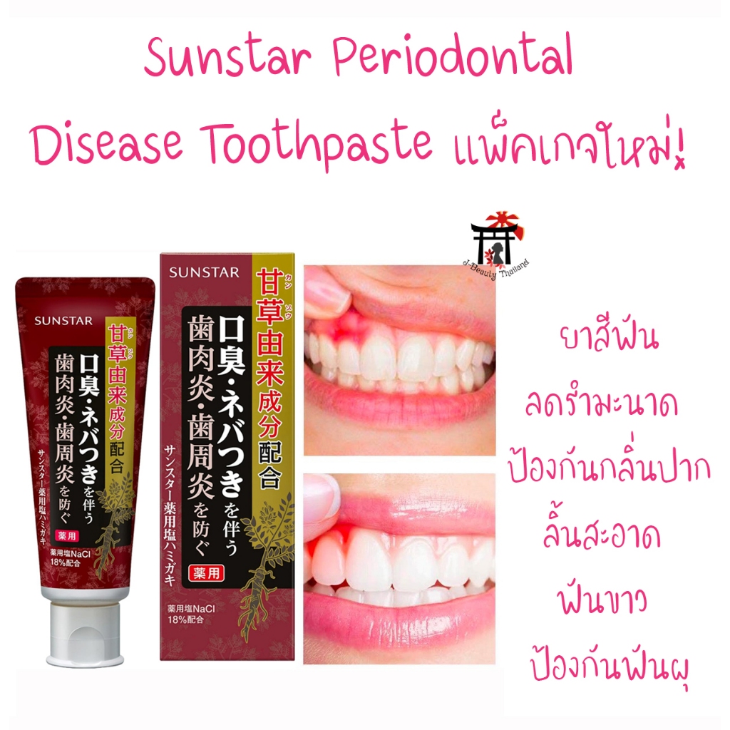 Sunstar Periodontal Disease Toothpasteยาสีฟันลดรำมะนาด ป้องกันกลิ่นปาก ลิ้นสะอาด ฟันขาว ป้องกันฟันผุ