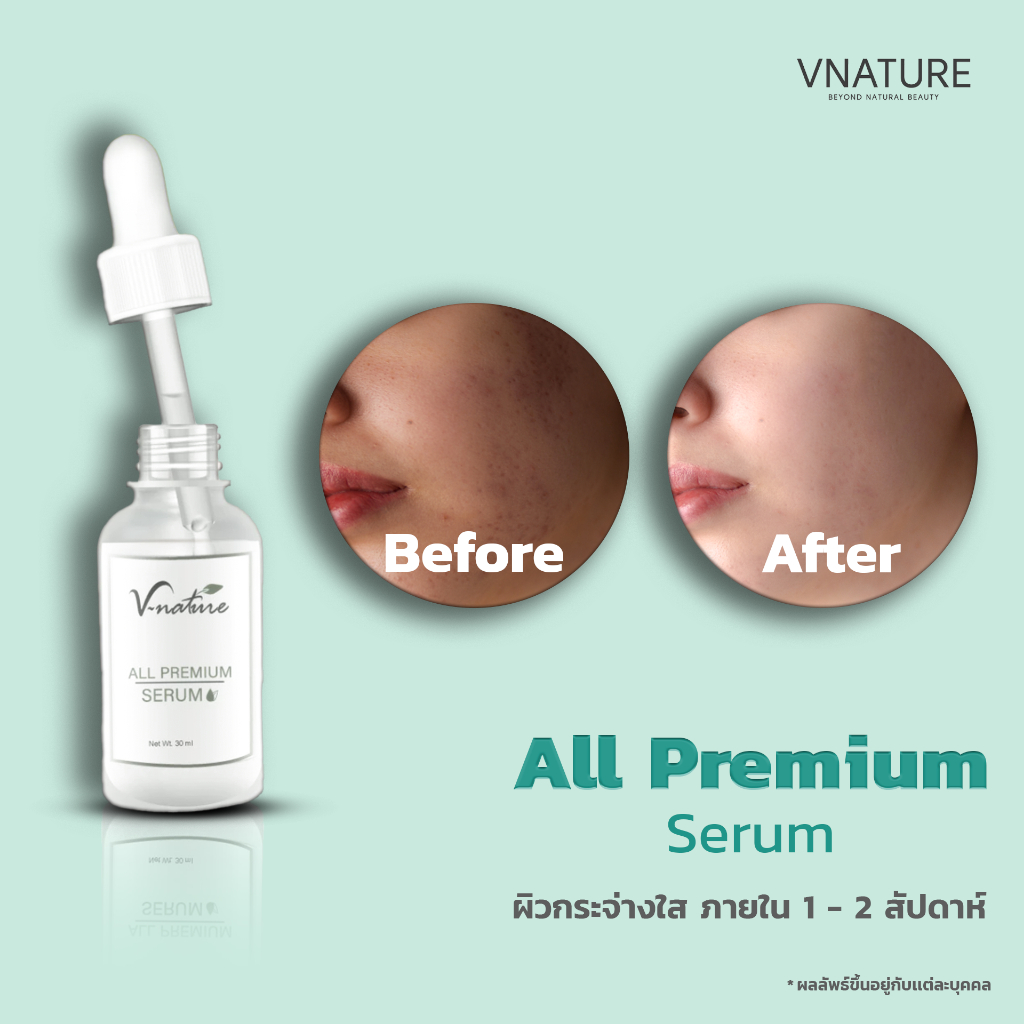 VNATURE เซรั่มไฮยาหน้าใส ลดสิว ลดรอย ผิวแพ้ง่าย ผิวติดสาร 30ml. All Premium Serum