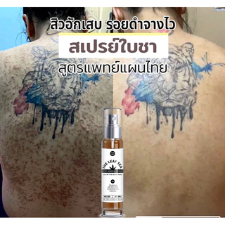 สเปรย์รักษาสิวที่หลัง สิวหน้าอก สิวใบหน้า สูตรแพทย์แผนไทย สเปรย์รักษารอยดำหลัง สเปรย์ใบชา