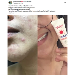PEURRi Anti Acne Gel เจลแต้มสิว ขนาด 8 g.