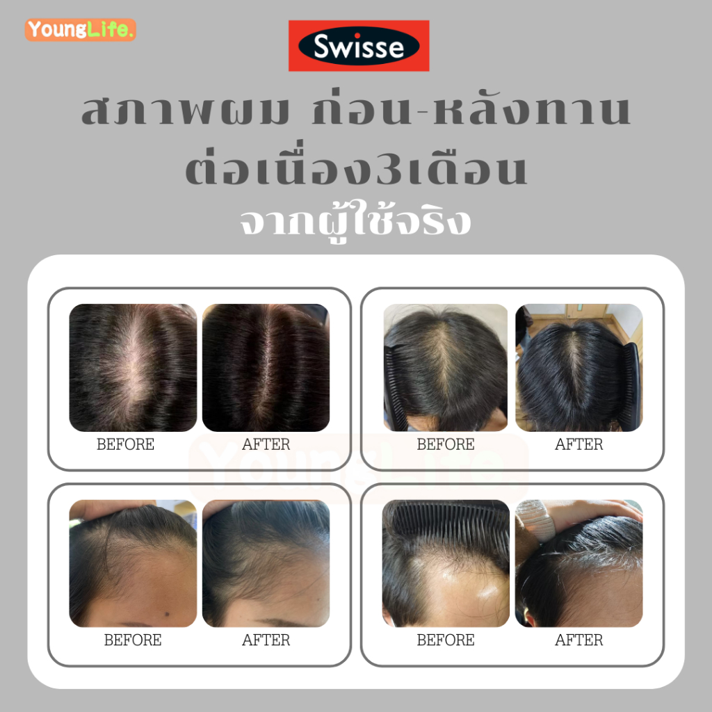 Swisse Beauty Hair Skin Nails Gummies สวิสเซ กัมมี่ อาหารเสริม บำรุงผมให้สุขภาพดีและแข็งแรง 50 เม็ด
