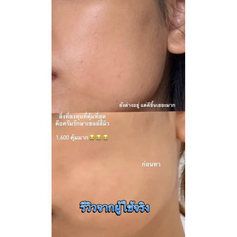 ส่งฟรี Vitiskin ขนาด50 มล ลดรอยด่างขาว ปรับสีผิวให้สม่ำเสมอ ของแท้💯% - รูปที่ 7