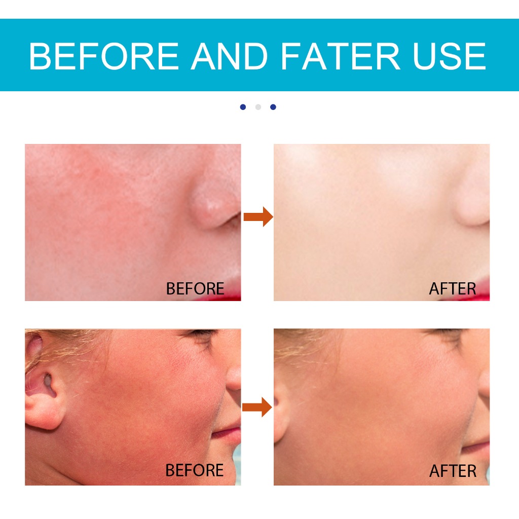 JAYSUING กันแดดแบบแท่ง กันแแด สูตรไฮยาลูโรนิค แอซิด SPF50+ PA+++ ครีมกีนแดด แห้งไว ไม่เหนียวเหนอะ - รูปที่ 4