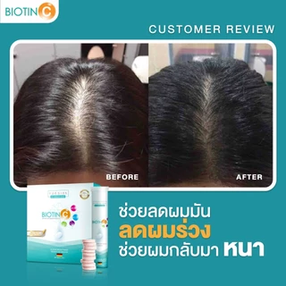 Vdesign Biotin C+ วิตามินลดผมร่วง เพิ่มผมหนา By Vibhavadi
