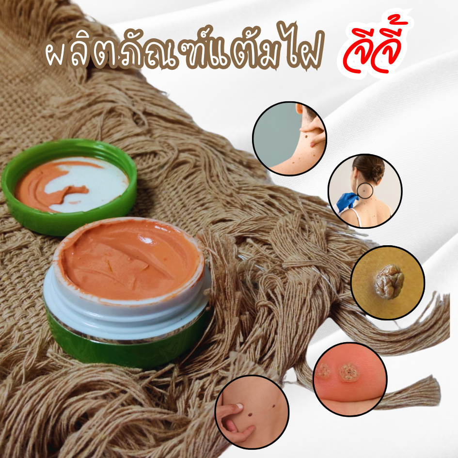 ผลิตภัณฑ์ไฝ จีจี้ แต้มไฝ ขี้แมลงวัน ติ่งเนื้อ หูด ตาปลา  สิวหิน ครีมแต้ม  ครีมไฝ แต้มไผ่ ครีมไฝ