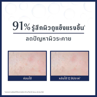 Eucerin ยูเซอริน อัลตร้าเซนซิทีฟ รีแพร์ เจล 50มล. Eucerin Ultrasensitive Repair Gel Cream 50ml