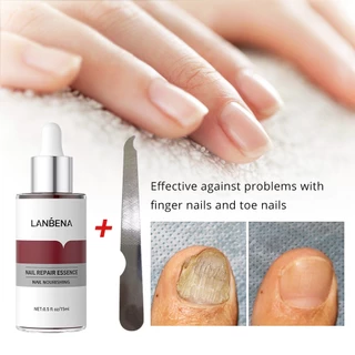 LANBENA เจลซ่อม ดเชื้อราที่เล็บโรคเชื้อราที่เล็บ ​โรคเชื้อราที่เล็บครีมบํารุงผิวนิ้วเท้า บำรุงเล