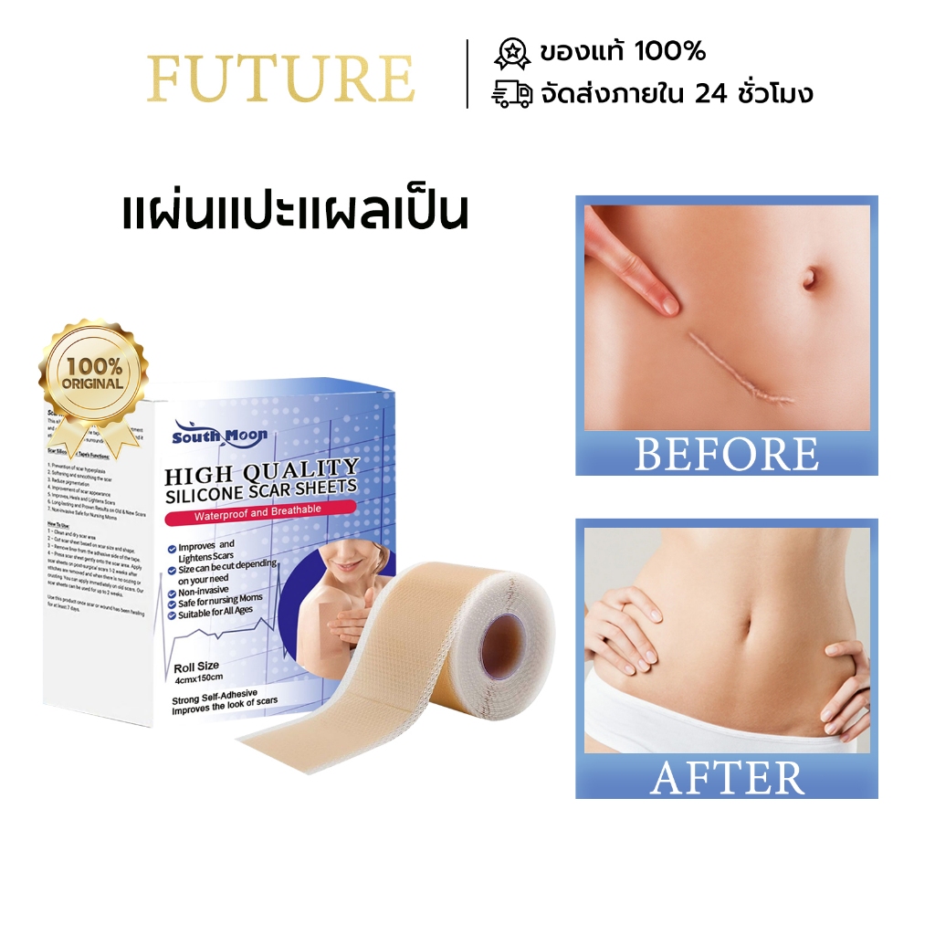 【🚚พร้อมส่ง】South Moon silicone scar sheet รักษารอยแผลเป็น แผ่นแปะแผลเป็น คีลอยด์ แผลนูน กําจัดรอยแผล