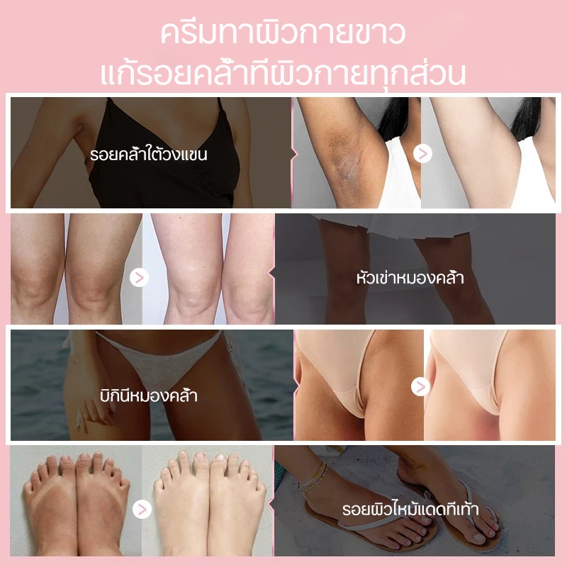 ครีมทาขาหนีบขาว ครีมทารักแร้ขาว ครีมไวท์เทนนิ่ง 100g ลบเมลานิน ใช้ทาข้อศอก ข้อเข่า คอ ขา บิกินี่ หน้า รักแร้ ฯลฯได้ - รูปที่ 3