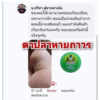 ครีมไฝจีจี้ ขี้แมลงวัน ติ่งเนื้อ หูด ตาปลา แก้ปัญหา กระ สิวหิน ไฝ หูด จี้ไฝ แต้มตาปลา