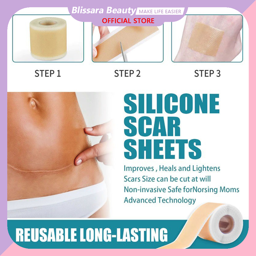 รักษารอยแผลเป็น แผ่นแปะแผลเป็น 4cm*150cm กําจัดรอยแผลเป็นจากแผลเ Silicone Scar Sheets Repair ซิลิโคนเจลแถบแพทช์ซิลิ