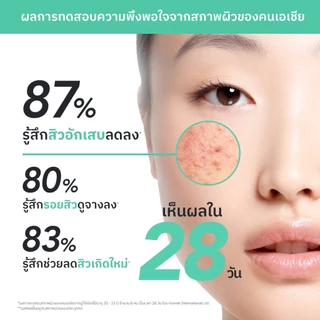 NU FORMULA Acne Solution Ampoule Serum 30ml เซรั่มดูแลปัญหาสิว BHA 2% ลดรอยแดง รอยสิว รอยดำจากสิว
