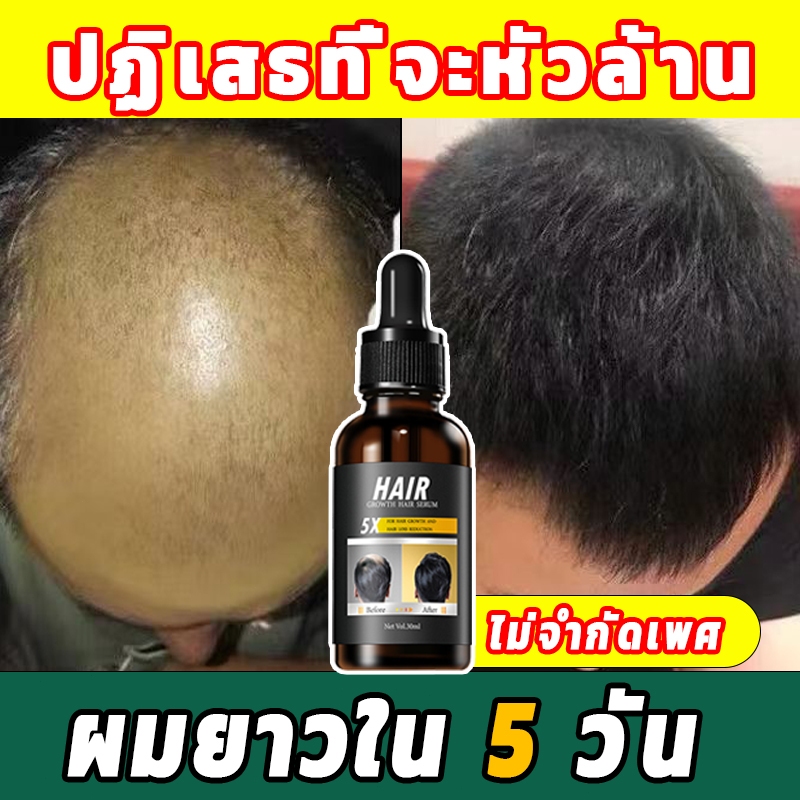 สินค้าแก้ปัญหาหัวล้าน เซรั่มปลูกผม ป้องกันผมร่วง น้ำยาเร่งผมยาว เซรั่มบำรุงผม บำรุงรากผม เซรั่มปลูกผมดก น้ำยาปลูกผมดก