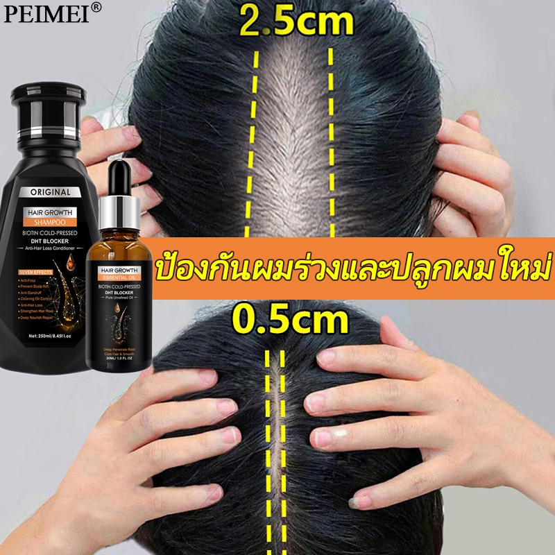 แชมพูแก้ผมร่วง แชมพูปลูกผมดก 250ml ยาสระผมแก้ร่วง แชมพูสำหรับลดผมขาดหลุดร่วง ป้องกันผมร่วงบำรุงผม ขิงบำรุงถึงราก