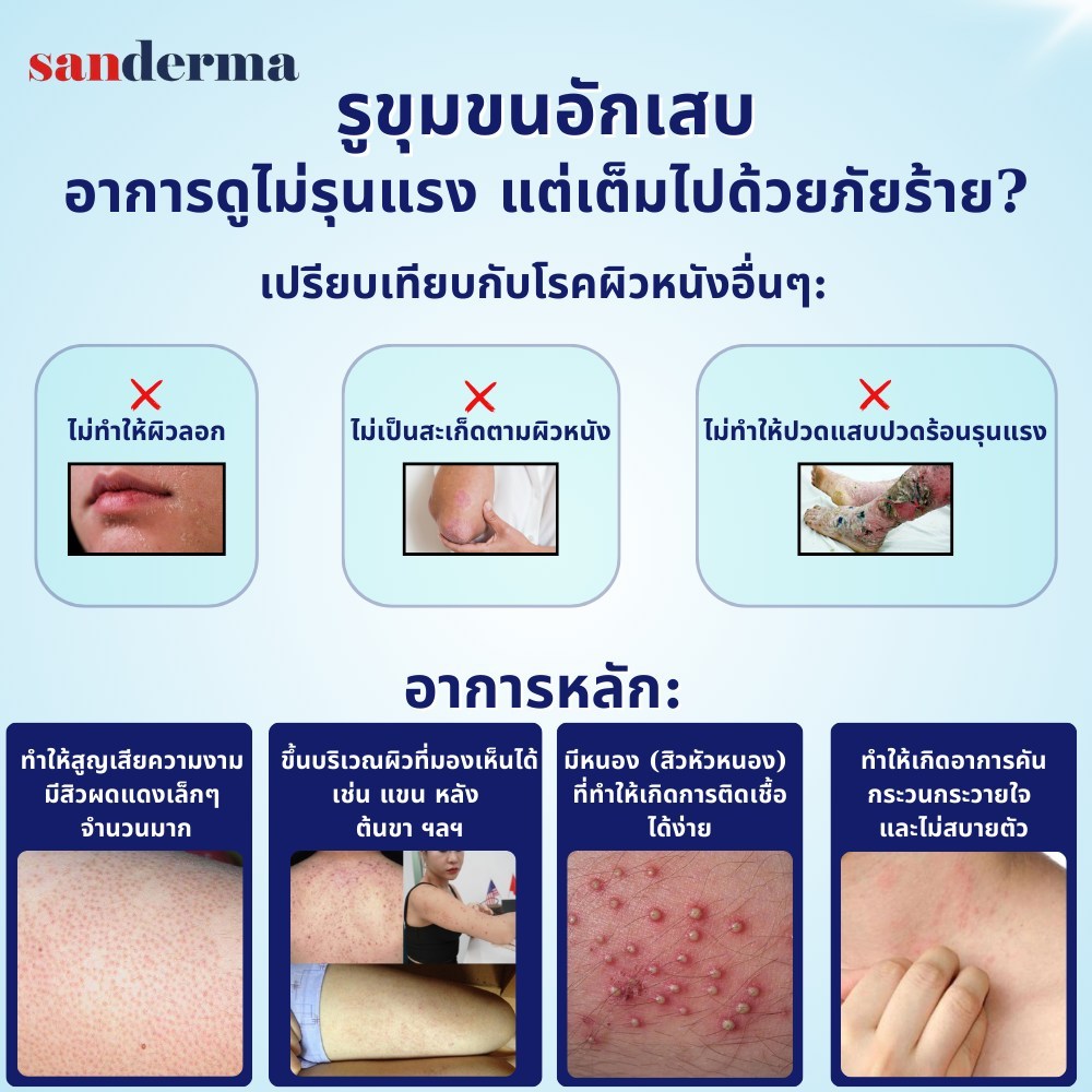COMBO ทาแก้คัน SANDERMA CREAM และ SERUM SANDERMA - รูปที่ 4