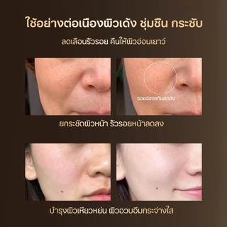 ครีมต่อต้านริ้วรอย ครีมลดริ้วรอย HOMER 50ml ลดริ้วรอยทุกชนิด ริ้วรอยหน้าผาก รอยร่องแก้ม ริ้วรอยตืนกา
