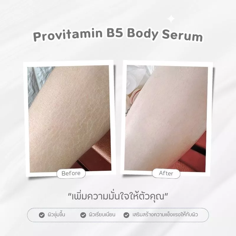 โปรโมชั่นสุดคุ้ม（ซื้อ 1 แถม 1 ） FEALI 5X Provitamin B5 ครีมบำรุงผิว ครีมบำรุงผิวแห้ง ผิวชุ่มชื้น เรียบเนียน วิตามินบี5 thumbnail 6
