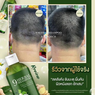 แชมพูสมุนไพรกำจัด เชื้อราบนหนังศรีษะ ลอก ขลุย หนังศรีษะแห้ง กลากเกลื้อน ผมมันรังแค แชมพูขุนเดช