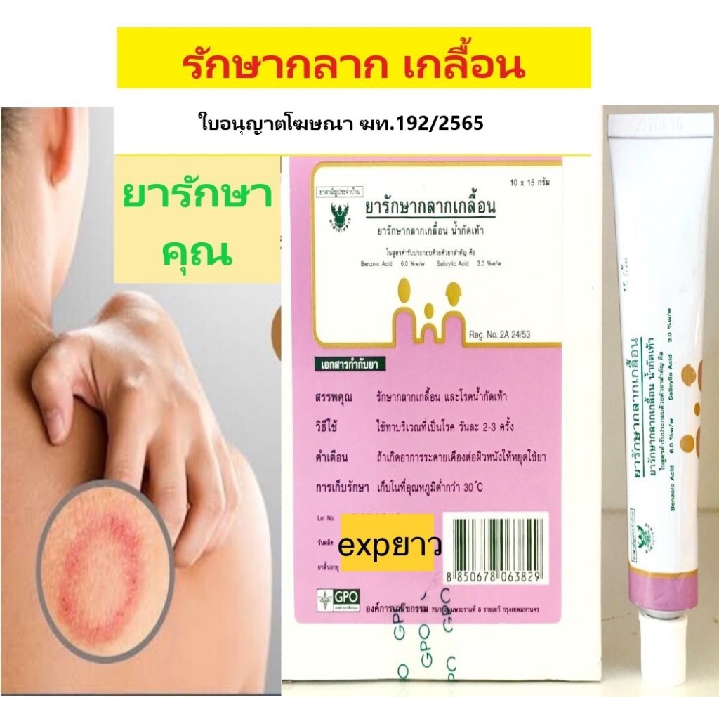 ยารักษากลาก เกลื้อน เชื้อรา องค์การเภสัช 15g โปรโมชั่น