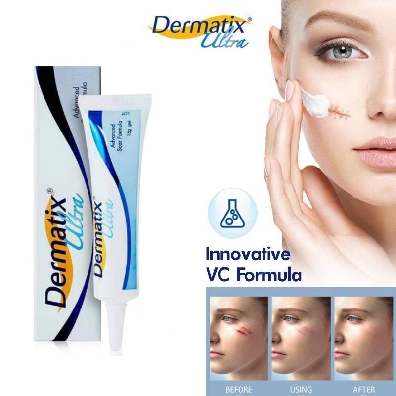 Dermatix Ultra Gel 15g ของแท้ 100% ลดรอยสิว รอยไหม้ Scar gel เจลบำรุงผิว แผลเป็นจากการผ่าตัด รอยแผลเป็น