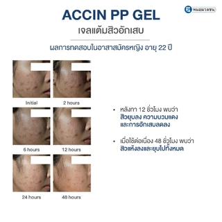 หมอมวลชน แอคซิน พีพี เจล (Accin PP Gel)