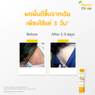 Mama's Choice ครีมทาผื่นผ้าอ้อม ครีมทาผื่นเด็ก ปกป้องผิวลูกน้อย ลดการระคายเคือง อ่อนโยน ปลอดภัย 100% - Diaper Cream