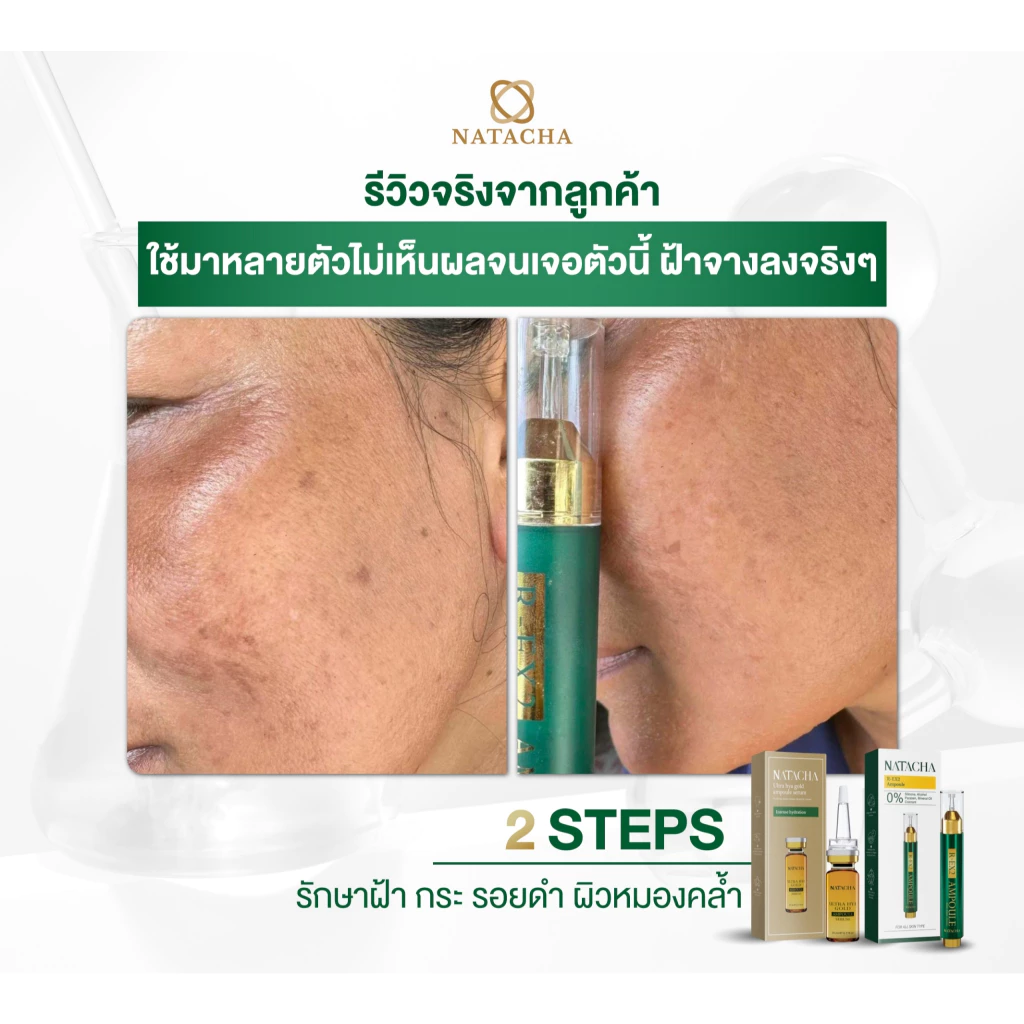 เซรั่มเข็มเปิดผิว แถม เซรั่มนาตาชา thumbnail 10