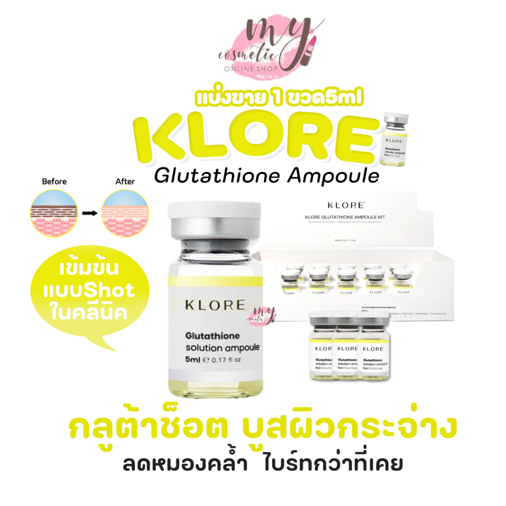 ( แท้ / พร้อมส่ง ) KLORE Glutathione Ampoule 5ml _ แบ่งขาย เซรั่มกลูต้า 1 ขวด 5 มิล