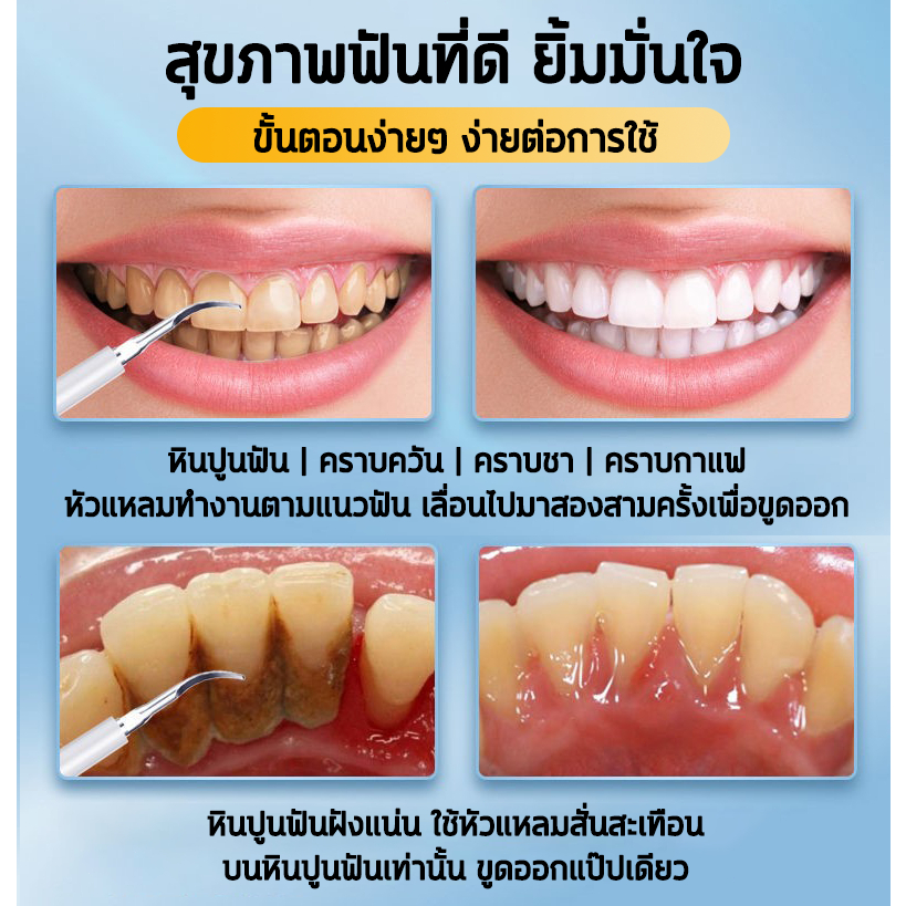 HYUNDAI เครื่องขูดหินปูน ที่ขูดหินปูน ขูดหินปูนเอง ไม่เจ็บเหงือก ขจัดหินปูนฟัน+แปรงฟัน - รูปที่ 5