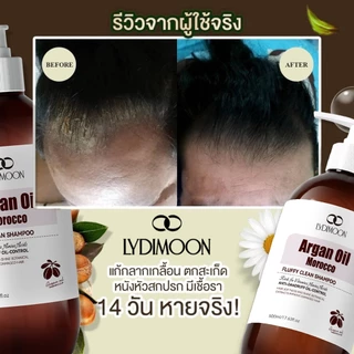 ยาสระผมขจัดรังแค แชมพูรังแค ยาสระผม 500ml ขจัดรังแค ลดคันหัว หยุดอาการคัน ลดผมร่วง แชมพูรักษาเชื้อราบนหนังศรีษะ