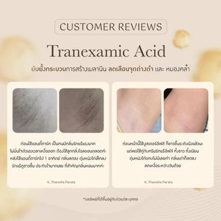 {🐻ในไลฟ์ลด50%+ส่งด่วนทุกวัน} ANTI DARK ARMPIT & BUM แอนตี้ดาร์ก ครีมทารักแร้อีฟส์ ปรับผิวขาว ลดตุ่มหนังไก่