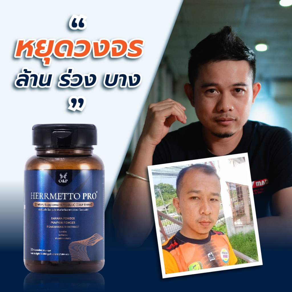 HERRMETTO Pro (เฮอร์เมตโต โปร) คอร์สดูแลเส้นผม แก้หัวล้าน บำรุงเส้นผม ให้หนาดกดำ ขนาด 30 แคปซูล – โปรปัง