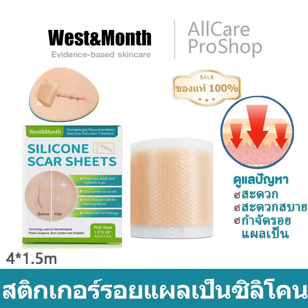 【 พร้อมส่ง】รักษารอยแผลเป็น แผ่นแปะแผลเป็น ซิลิโคนแผ่นรอยแผลเป็น 4cm*150cm กําจัดรอยแผลเป็นจากแผลเ silicone scar sheet